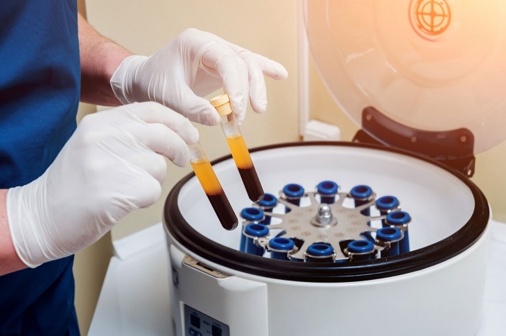 Fetal Bovine Serum & Potential Avenues for Sourcing